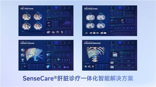 商湯醫療獲肝臟CT輔助診斷NMPA三類證，軟硬件零售賦能肝臟診療一體化新格局